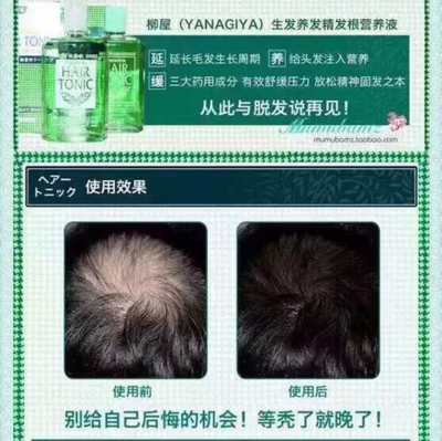 產后脫發怎么辦？這些方法幫你減少掉發，拒絕禿頂危機